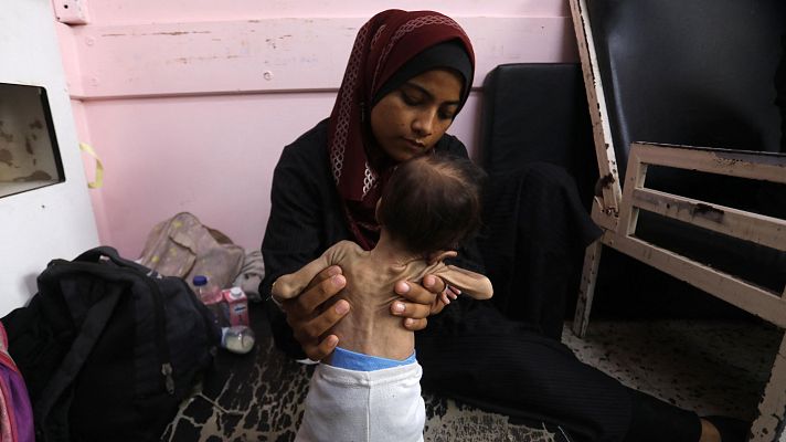 Informativo 24h - Voces del hambre desde Gaza