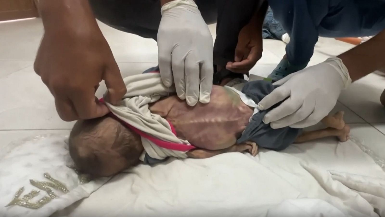 La hambruna azota la Franja de Gaza con muerte de menores diarias | Ver