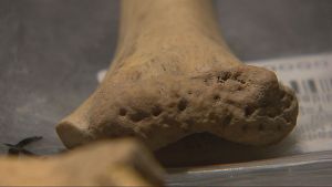Troben restes ssies que demostren prctiques canbals al Neoltic