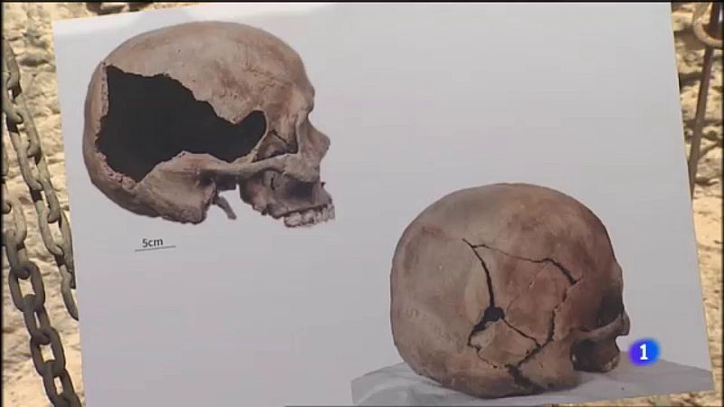 Recuperados más de 500 restos óseos en Pozo de Tenoya (Arucas) | Ver ahora