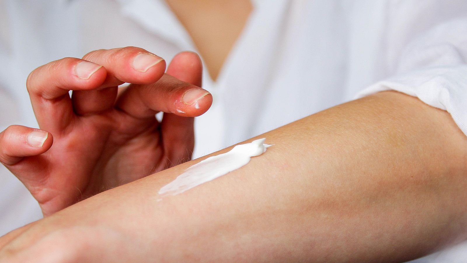 Melanomas, más frecuentes en la generación 'boomer' | Ver