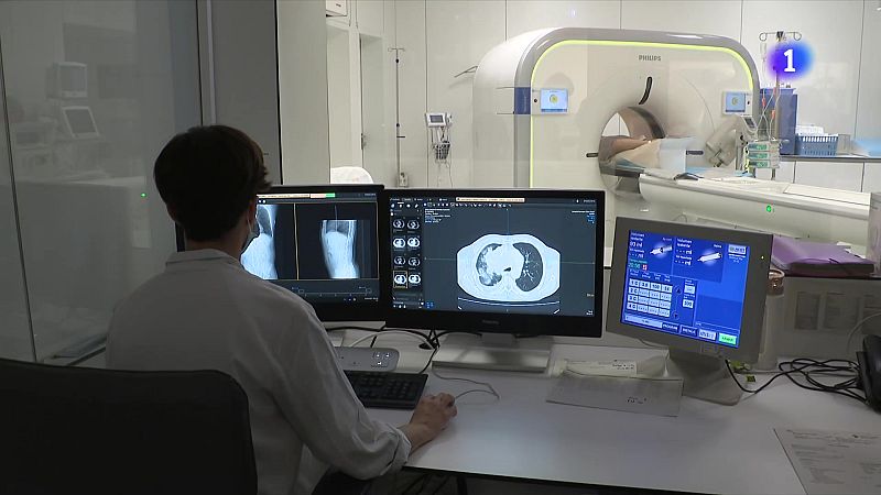 Cribratge precoç per millorar el diagnòstic del càncer de pulmó - L'Informatiu | Veure