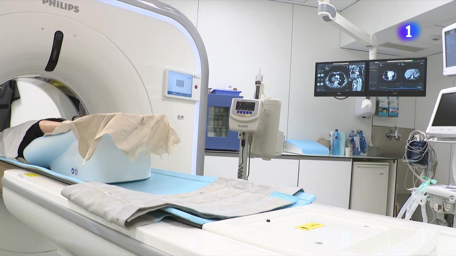 Un estudi eleva un 20% la supervivència del càncer de pulmó