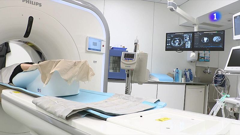 Un estudi eleva un 20% la supervivència del càncer de pulmó