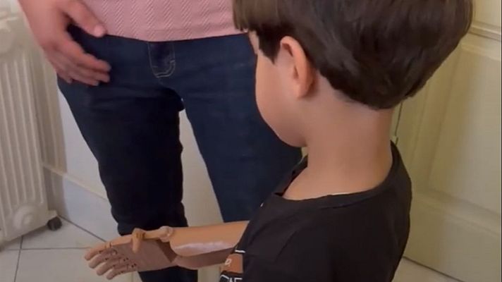 Fin de semana 24h - Prótesis solidarias para Gaza: "Palestina es el sitio con más niños amputados del mundo"