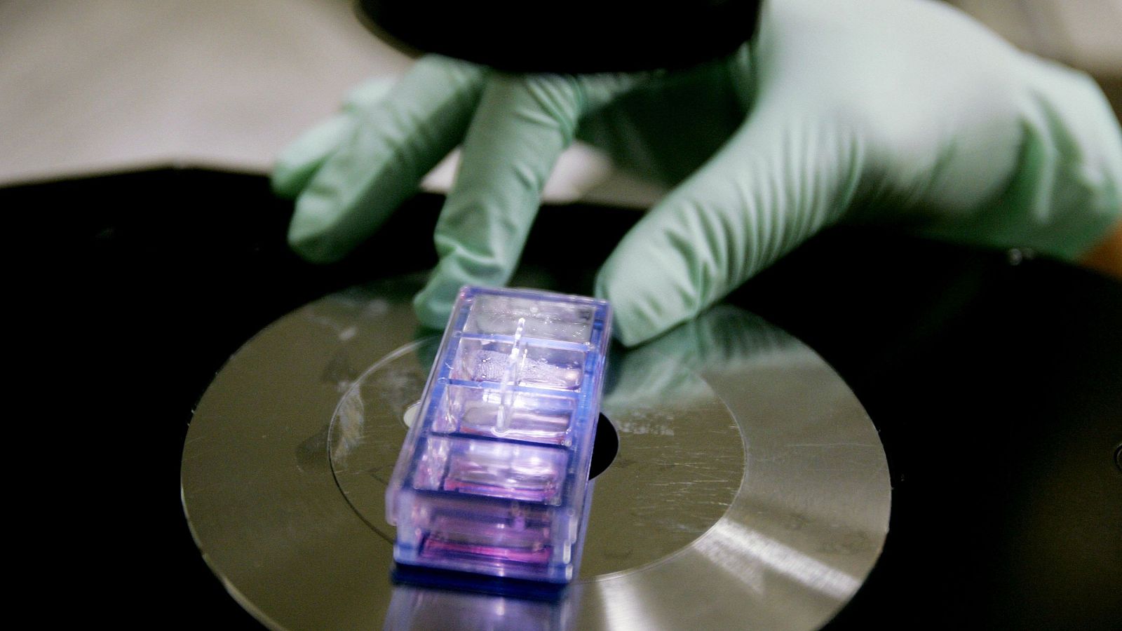 El linfoma, un cáncer cada vez más frecuente pero también con mejor tratamiento - Telediario 1 | Ver