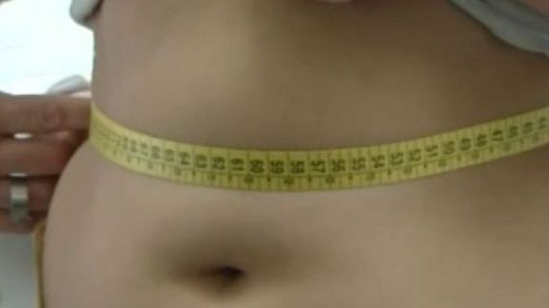 Gordofobia sanitaria, cuando los enfermos se convierten en pacientes de segunda