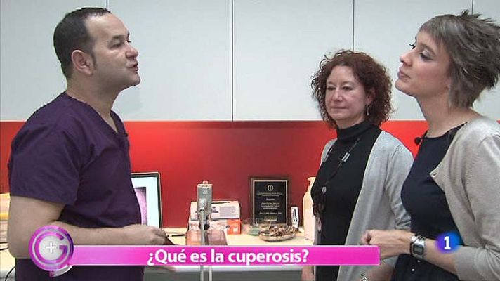 +Gente - Tratamiento contra la cuperosis