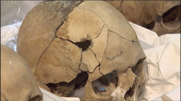 Telecanarias - Identificación de restos en Pozo de Tenoya (Arucas, Las Palmas)