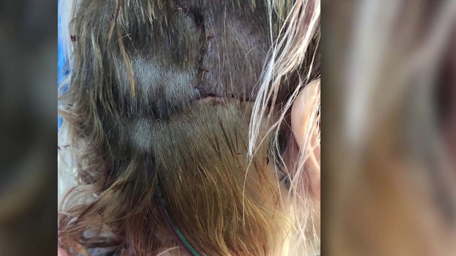 193 puntos por defender a su hijo de dos perros - Mañaneros 360 | Ver