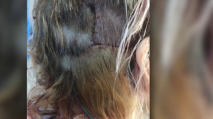 Mañaneros 360 - 193 puntos por defender a su hijo de dos perros