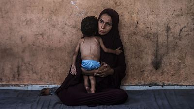 Más de 54.600 menores de cinco años padecen desnutrición aguda en Gaza, según un estudio