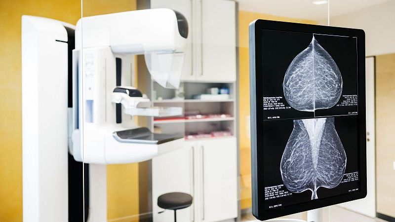 Errores en los cribados del cáncer de mama | Ver