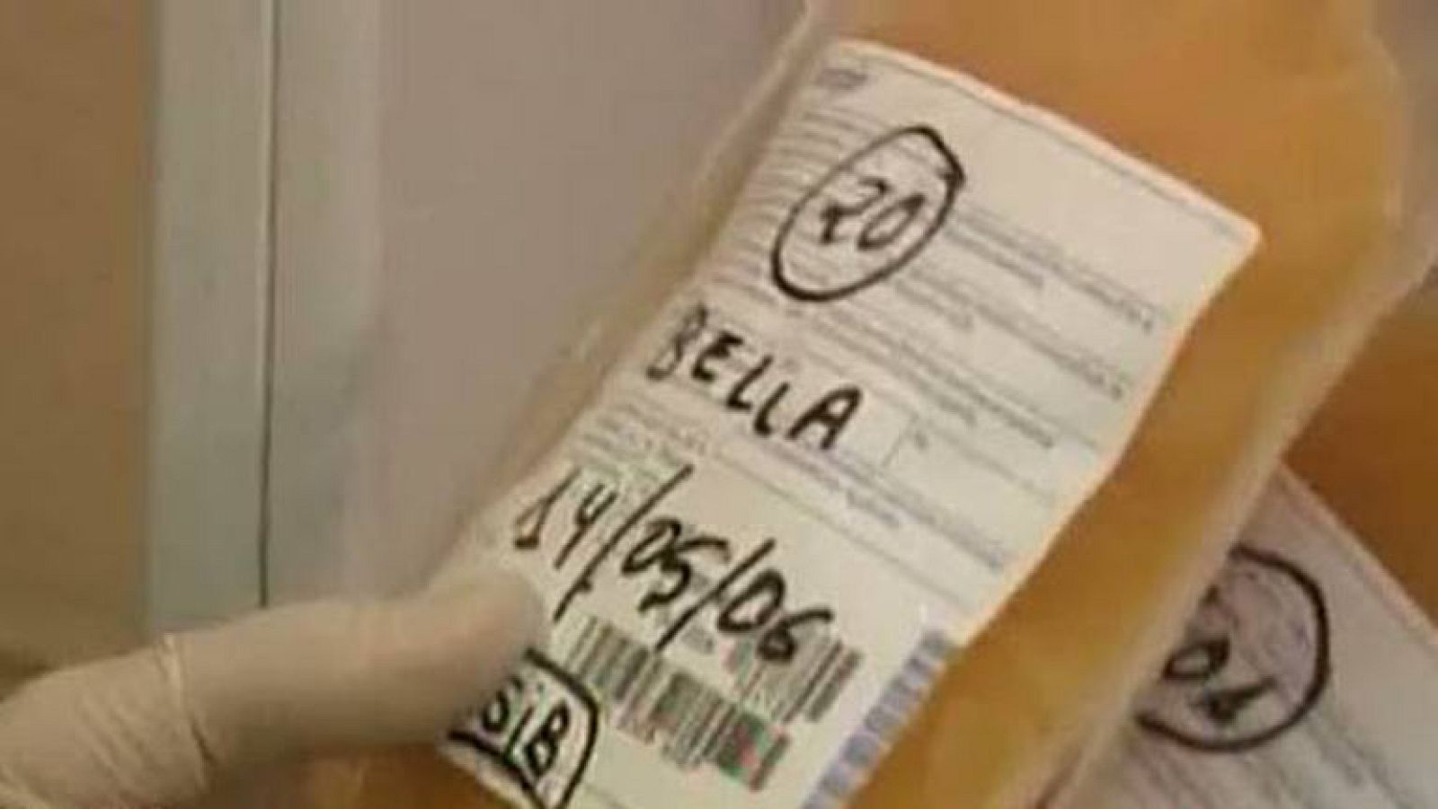 Las bolsas de sangre, prueba contra Eufemiano | Ver