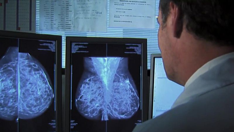 Congelen els cribratges de càncer - L'Altaveu al pati - L'altaveu al pati | Veure