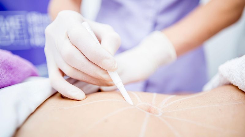 Intrusismo en la medicina estética | Ver