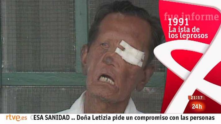 Informe Semanal - La isla de los leprosos
