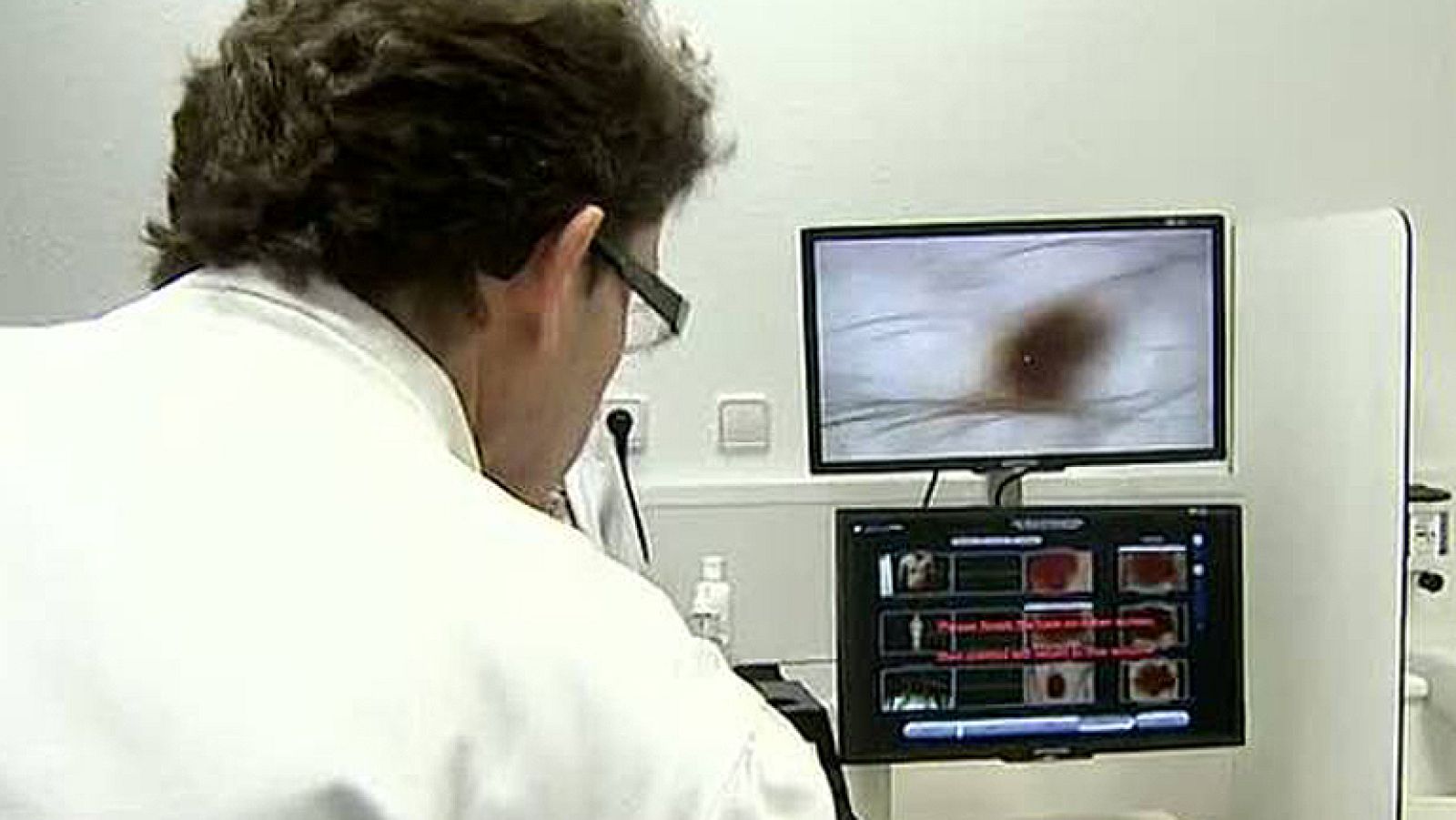 Los recortes sanitarios perjudican a los enfermos de cáncer, según las asociaciones