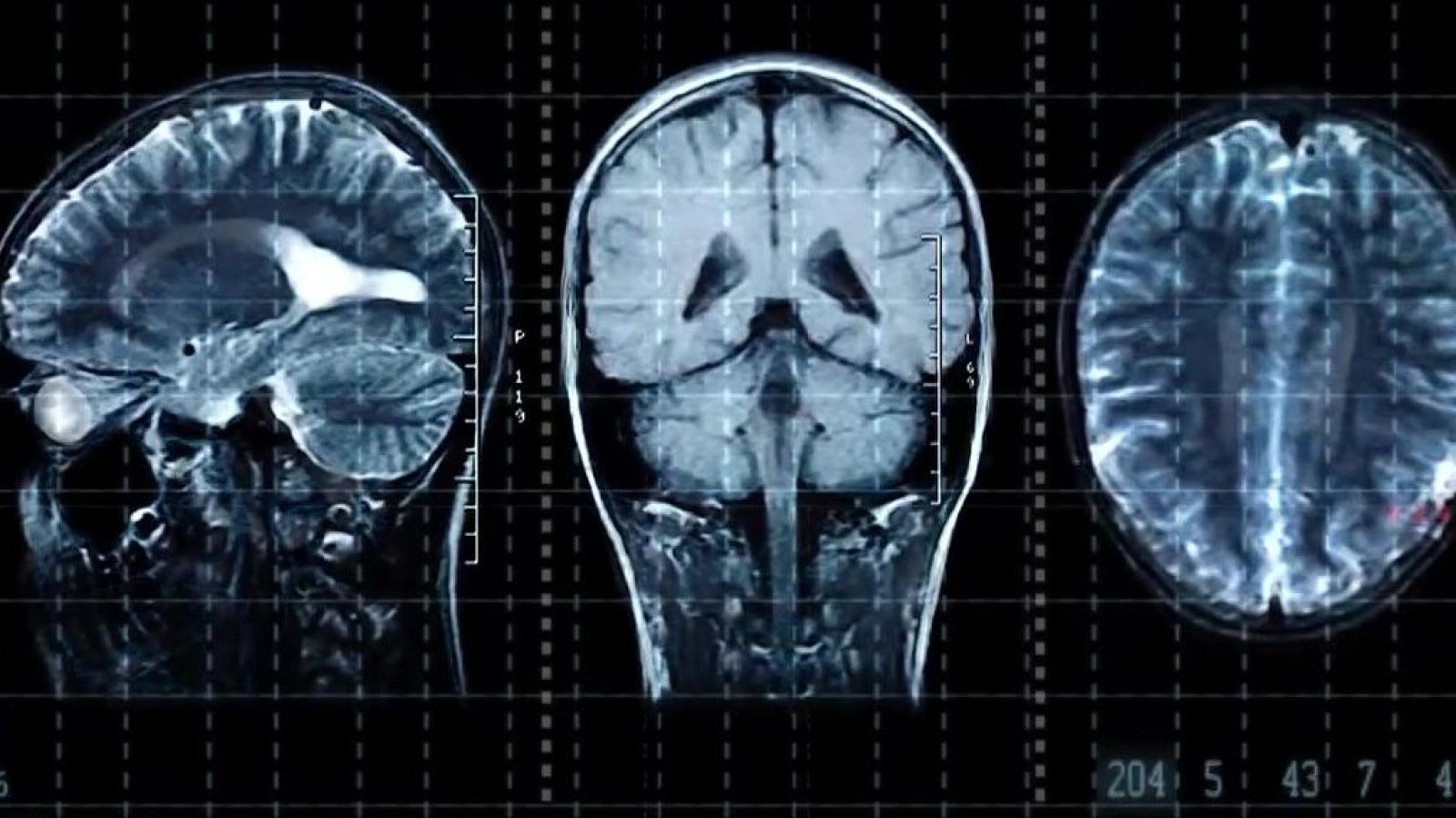 Les cinc edats del cervell - L'Altaveu - L'altaveu | Veure