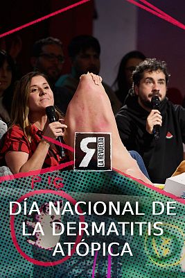 Día Nacional de la Dermatitis Atópica