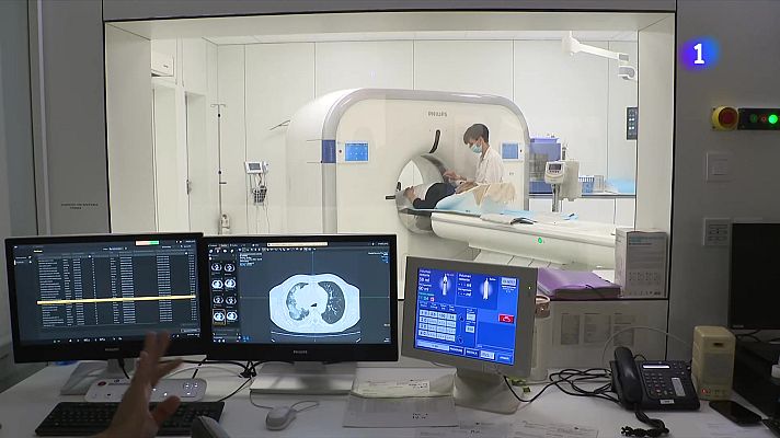 L'Informatiu - El càncer de pulmó augmenta un 6%, especialment en dones