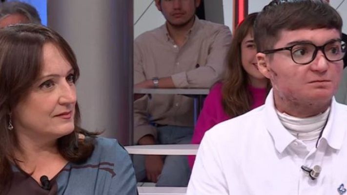 Directo al grano - El caso de Adrián un joven de 22 años que sufre piel de mariposa en 'Te doy la palabra', con Isabel Gemio