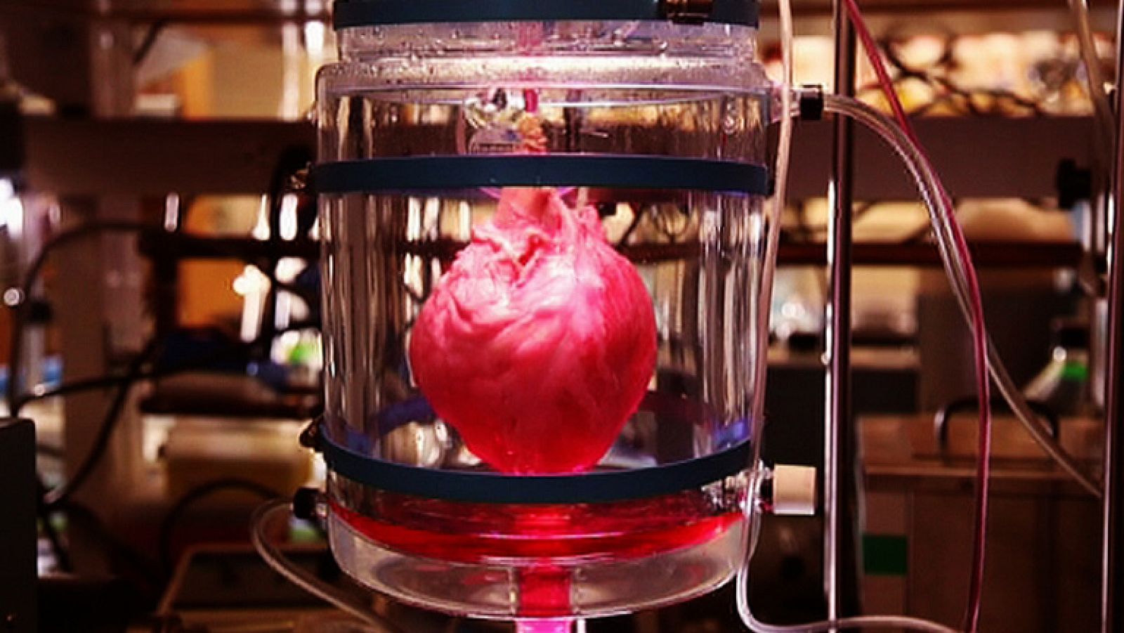 La Noche Temática - El corazón autosuficiente - Avance - La noche temática | Ver