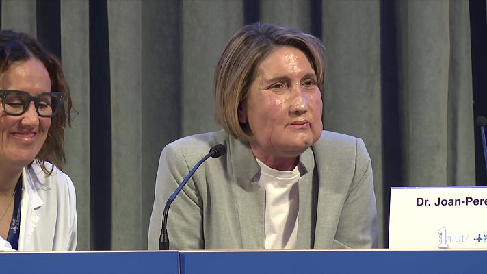 L'Informatiu - La Vall d'Hebron fa el primer trasplantament de cara amb una donant que va rebre l'eutanàsia