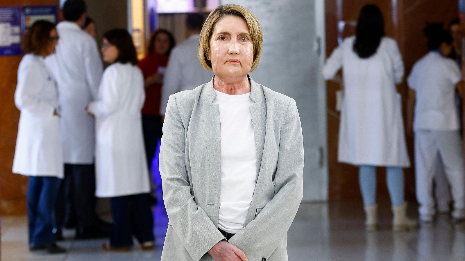 El hospital Vall d’Hebron realiza un trasplante de cara a partir de una donante que recibió la eutanasia - Telediario 1 | Ver