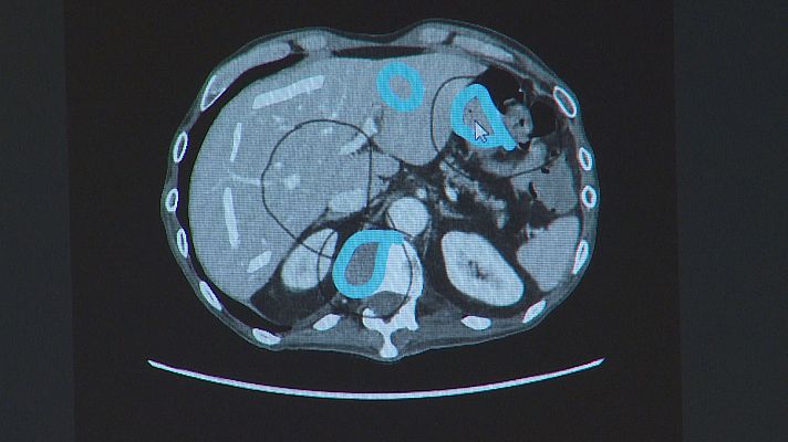 Noticias Aragón - Noticias Aragón 2 - 04/02/26