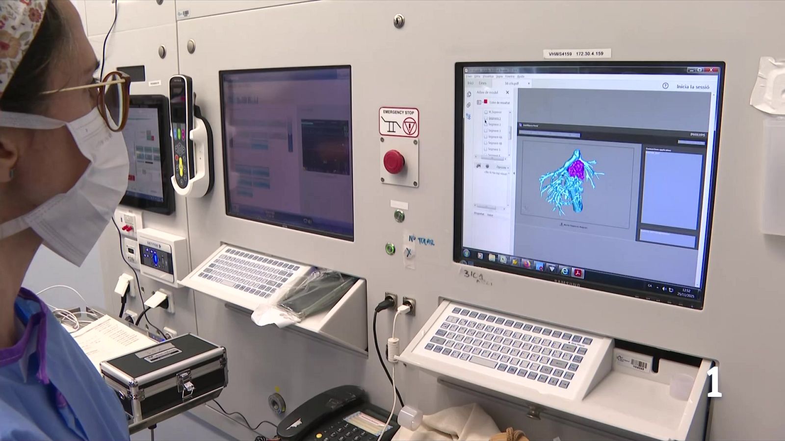 Vall d'Hebron extreu un tumor hepàtic amb una tècnica de trasplantament