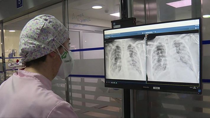 Telenorte - País Vasco - Cumple un año la primera unidad que atiende a pacientes con COVID persistente en Euskadi