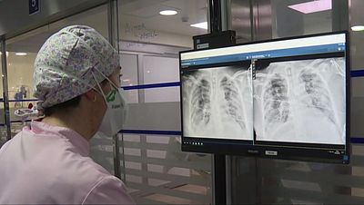 Cumple un a�o la primera unidad que atiende a pacientes con COVID persistente en Euskadi | RTVE Play - Ver ahora