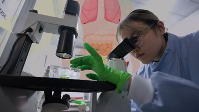 Endometriosis, esperanza en nuevas terapias