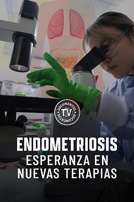 Endometriosis, esperanza en nuevas terapias