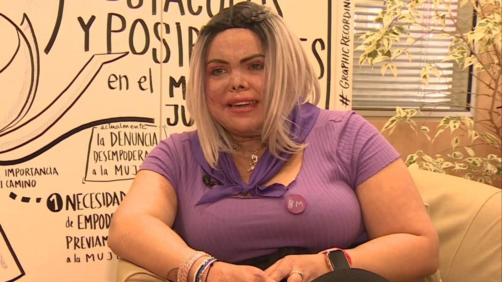 Doribel, superviviente de violencia machista quemada por su expareja, alza la voz este 8 de marzo | RTVE Play - Ver ahora