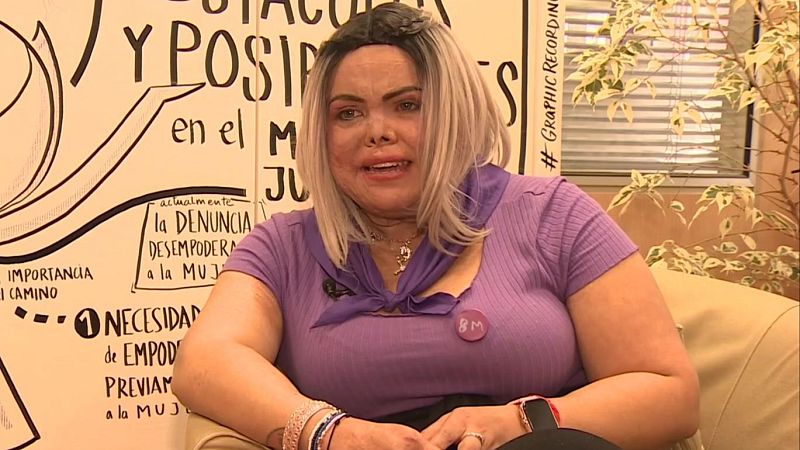 Doribel, superviviente de violencia machista quemada por su expareja, alza la voz este 8 de marzo | RTVE Play - Ver ahora