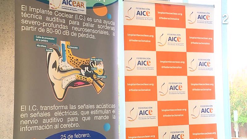 Actividades del movimiento asociativo de AICE - En lengua de signos | Ver