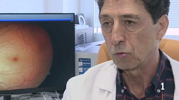 Informativo Telerioja - Día del glaucoma