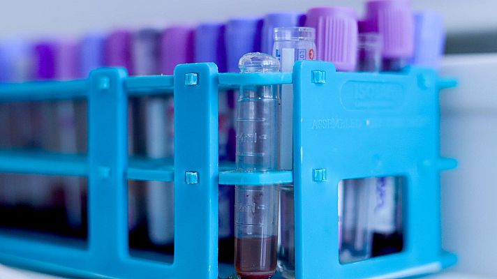 Noticias de Castilla-La Mancha - Descubren proteínas clave en el desarrollo de los sarcomas