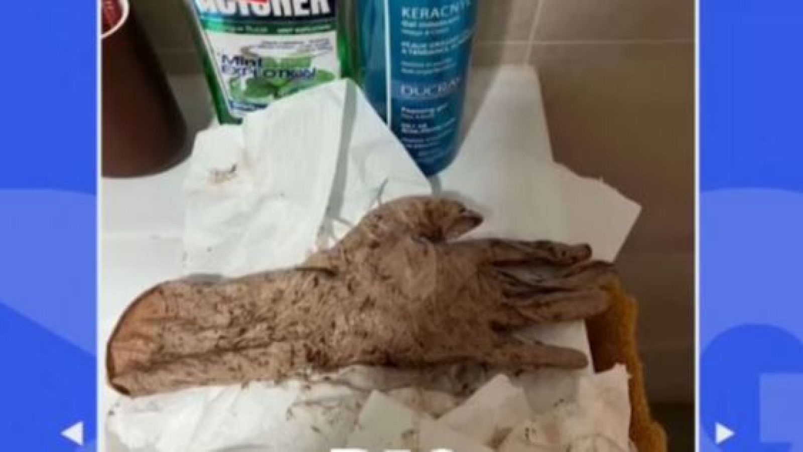 Una mujer termina pariendo un guante con gasas por una negligencia médica extrema - Directo al grano | Ver