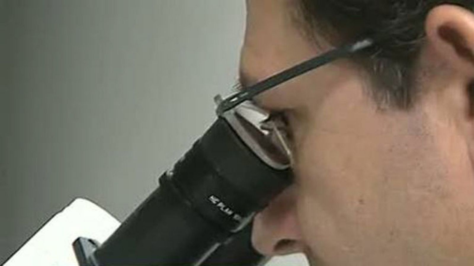 Un nuevo mecanismo regula los genes de las células tumorales | Ver