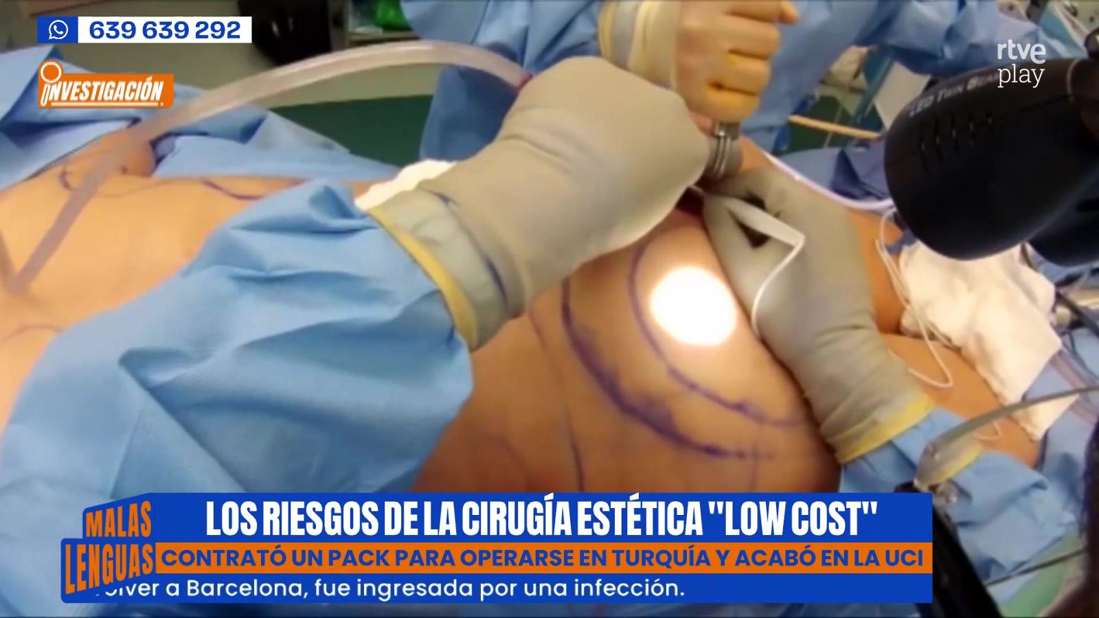 Los riesgos de la cirugía estética 'low cost' - Malas lenguas | Ver