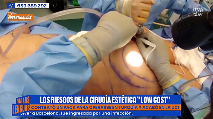 Malas lenguas - Los riesgos de la cirugía estética 'low cost'