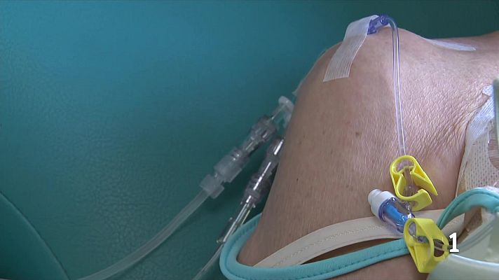 L'Informatiu - L'VHIO posa en marxa un nou assaig clínic amb teràpia CAR-T en persones