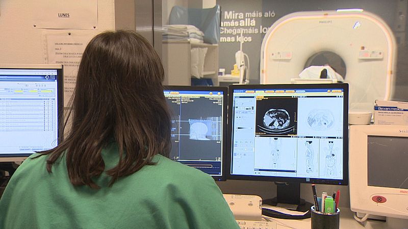 Síndromes compresivas vasculares: difíciles de diagnosticar e moi condicionantes