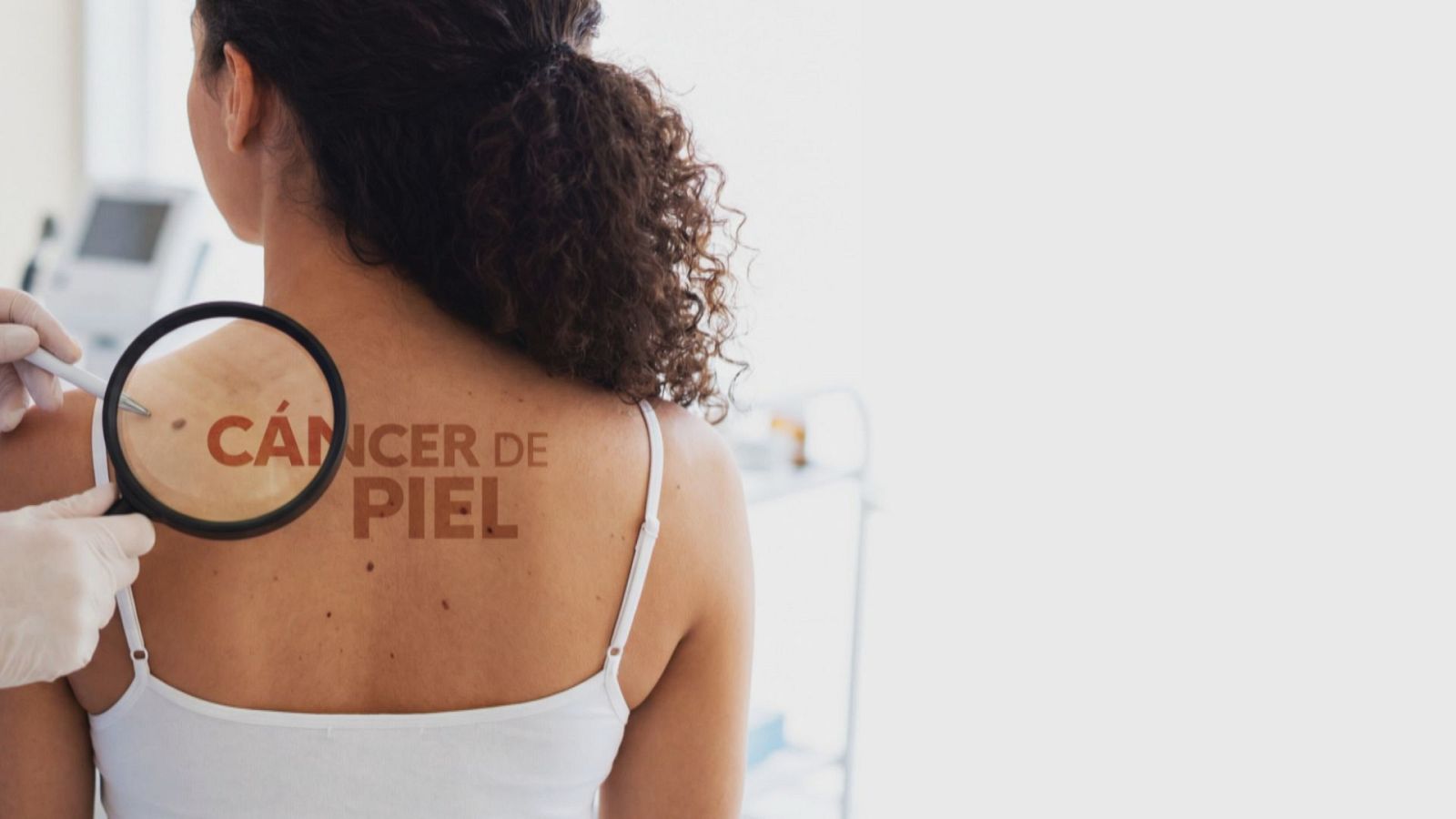 Prevención del cáncer de Piel - Noticias Andalucía | Ver