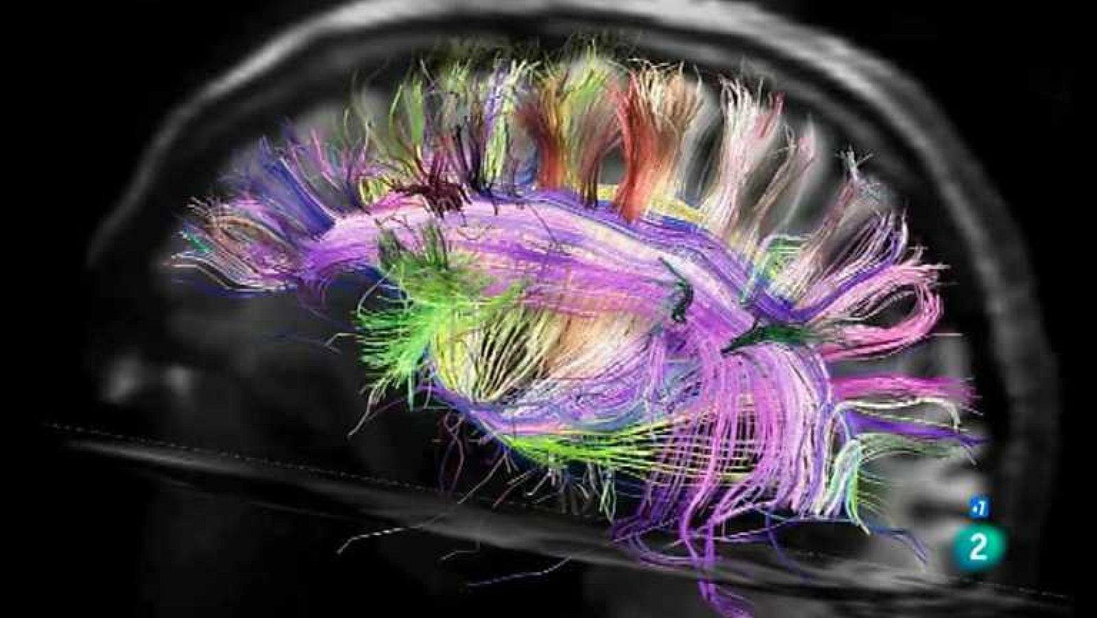 Soy cámara. El programa del CCCB - ¿Qué nos hace humanos? - ver ahora