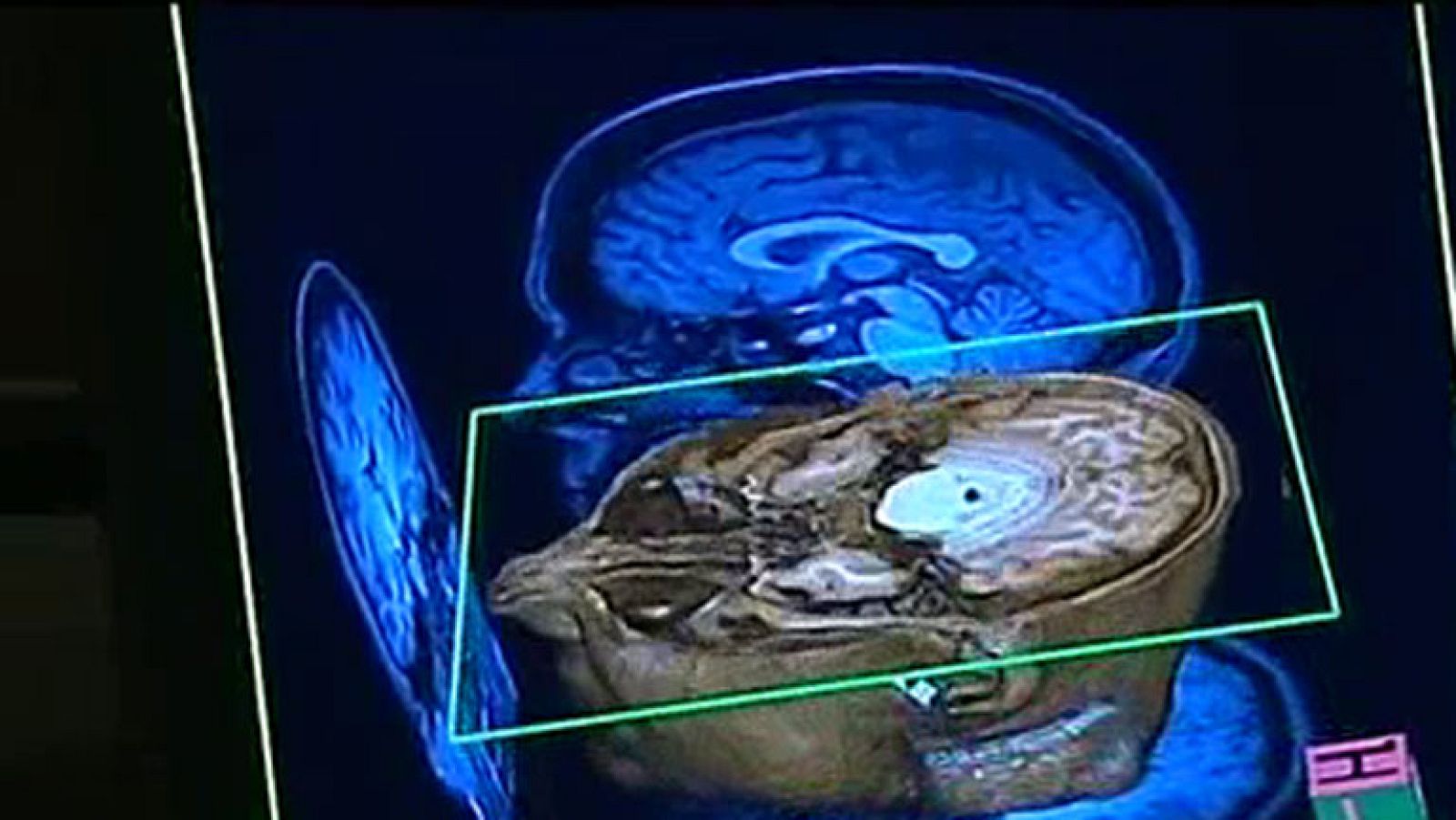 Mapa del cerebro humano