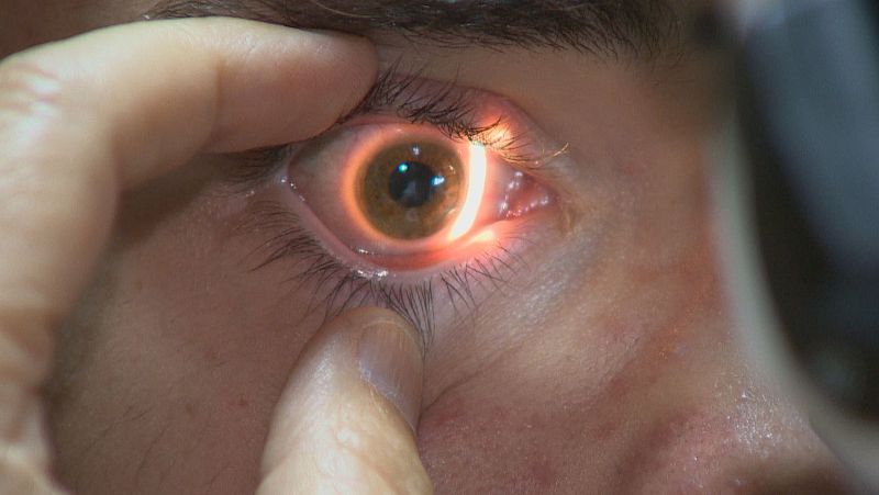 Viaje al centro del ojo: ¿Por qué debemos ver el eclipse con gafas homologadas? - Noticias de Castilla y León | Ver